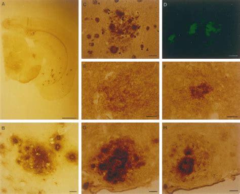 Immunohistochemical And Histological Characterization Of Amyloid