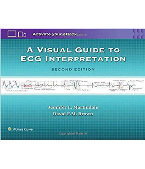 A Visual Guide To Ecg Interpretation Ed Pb Buy A Visual Guide