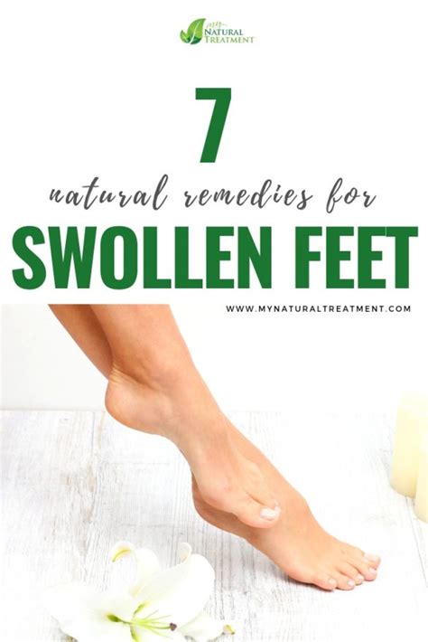 7 Easy Natural Remedies for Swollen Feet with Mistletoe