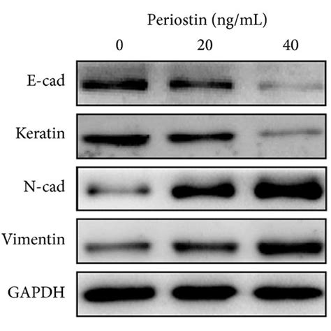 Effects Of Periostin On Emt Related Markers Ilk And P Akt In Eecs P