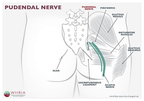 pudendal-nerve - Whria