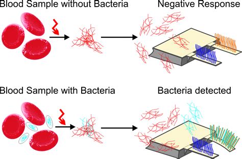 Biosensors Free Full Text Rapid Bacteria Detection From Patients