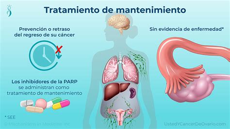 Presentación de diapositivas Tratamiento y manejo del cáncer de ovario