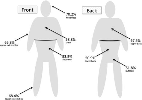 Percentage And Distribution Of Folliculotropic Mycosis Fungoides