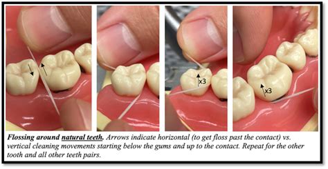 Is Flossing Really That Important Wright Patterson Afb Article Display