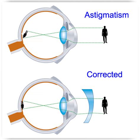 Astigmatism Eye Exams Optometrists Oxford And Henderson Nc