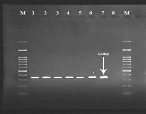 Agarose Gel Electrophoresis Analysis Of 16s Rrna Gene Amplified From