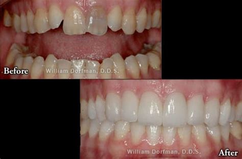 Bill Dorfman Dds Century City Aesthetic Dentistry Updated January 2025 80 Photos And 164