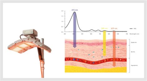 Photodynamische Therapie PDT Jetzt Einfacher Dermatologische