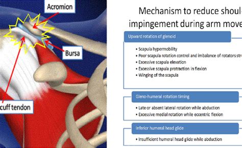 Shoulder Impingement Explained – Otosection