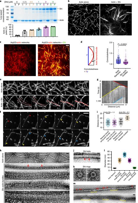 Shi Bundles Actin Filaments A Shi Bundles Actin Filaments In A