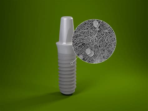 Ceramic Implants — Affordable Dental Implants