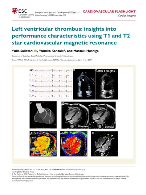 Pdf Left Ventricular Thrombus Insights Into Performance Characteristics Using T1 And T2 Star