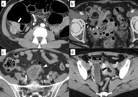 representative imaging findings  worrisome features  abdominal