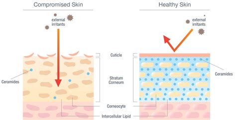 What Is The Skin Barrier Heres Everything You Need To Know