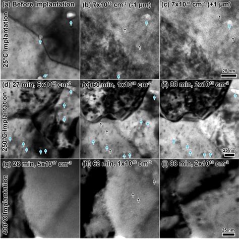 Bf Tem Micrographs Approximately À 1 Lm Defocus Showing An Overview