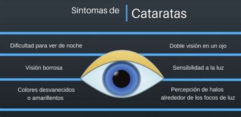 Cataratas Clinica Sagrario