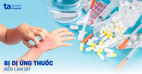 mắc phải dị ứng thuốc nên thực hiện thế nào Hướng dẫn cách xử lý chuẩn