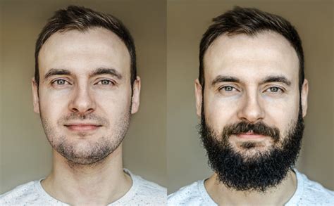 How To Fix A Patchy Beard Bossman Brands