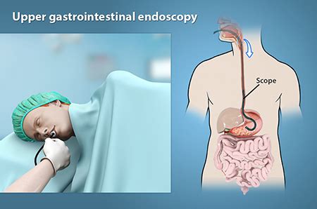 Endoscopy Strathpine | Colonoscopy Moreton Bay Region, Caboolture