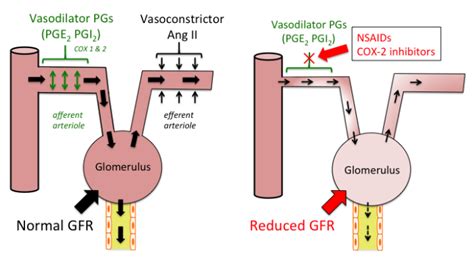 Nsaidsideeffects Tusom Pharmwiki