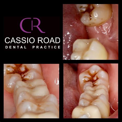 Smile Gallery Cassio Road Dental Practice Dental Practice Offering