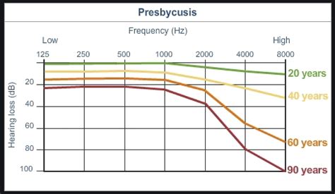 Widex-Moment-MRR2D-Hearing-Loss-by-Age-Graph-Cochlea-EU - HomeTheaterHifi.com