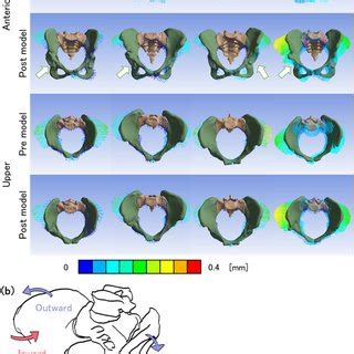 (a) Resultant displacement vector diagrams of the pelves on anterior ...