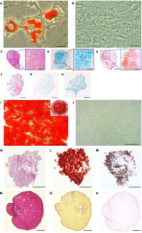 Adipogenic Chondrogenic And Osteogenic Differentiation Of Adscs Download Scientific Diagram