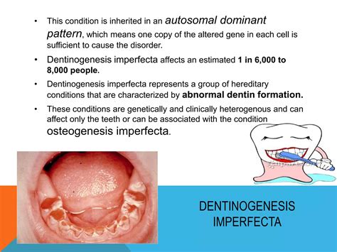 Dentinogenesis Imperfecta Ppt