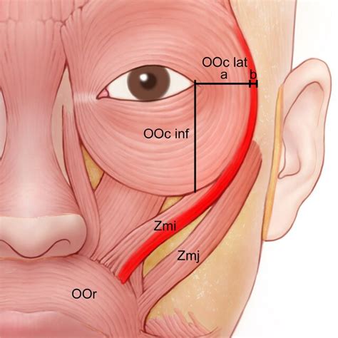 Lateral And Inferior Lengths Of The Orbicularis Oculi Muscle Ooc And Download Scientific