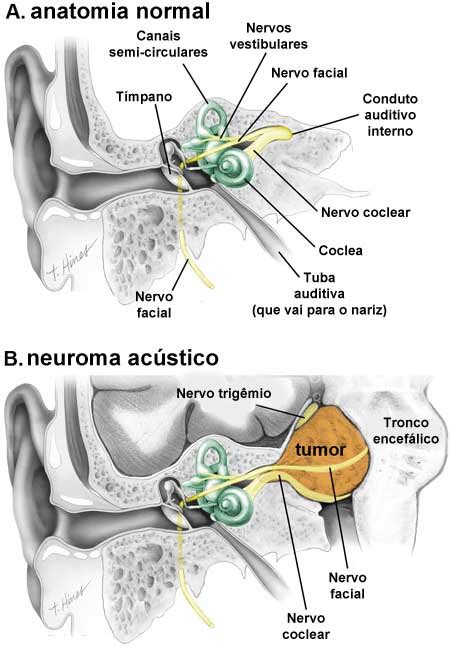 Sinus Oto Centro Otorrinolaringologia