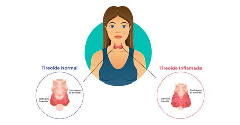 Menstruação atrasada as 9 causas comuns e o que fazer Bem Estar