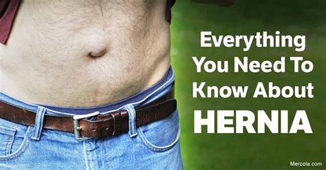 Everything You Need to Know About Hernia