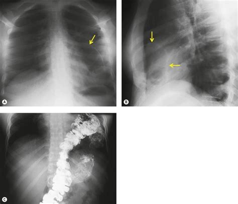 16 Congenital Anomalies Radiology Key