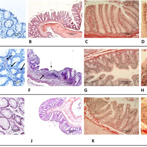 Histology Of The Colon Mucosa From Healthy Dss And Aom Treated Rats