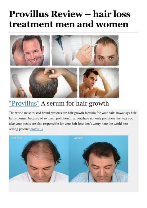 Ppt Provillus Review Hair Loss Treatment Men And Women Powerpoint