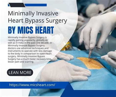 Minimally Invasive Heart Bypass Surgery In India Experienc Flickr