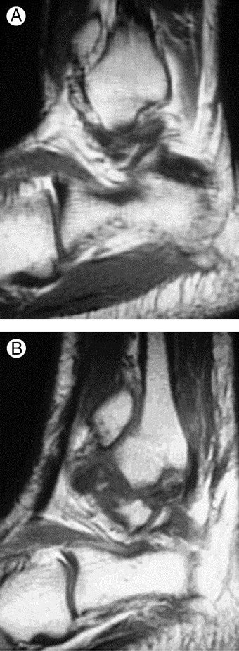 The Usefulness Of Magnetic Resonance Imaging In The Diagnosis Of