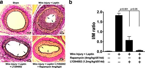 Vascular Smooth Muscle Cell Proliferation In Restenosis Circulation