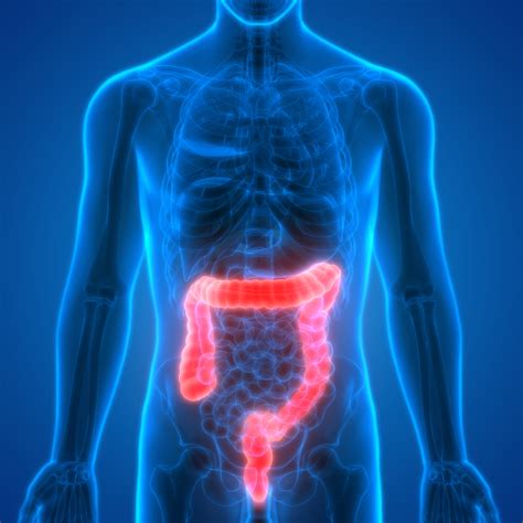 Colorectal Cancer Carcinoma Of The Colon Maintrac