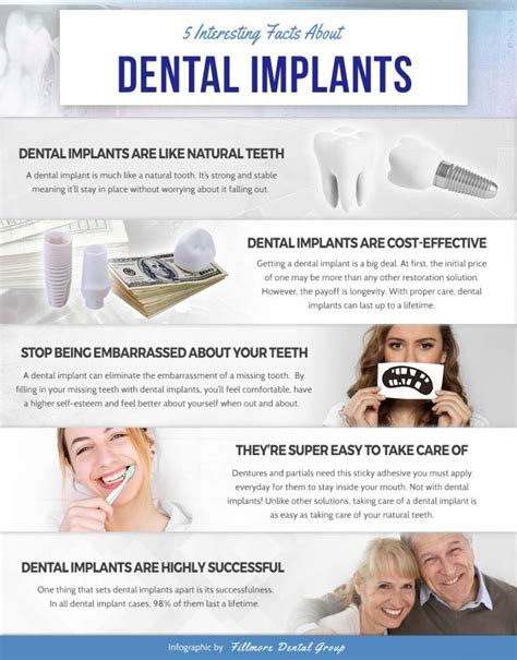 5 Interesting Facts About Dental Implants Infographic Fillmore Dental