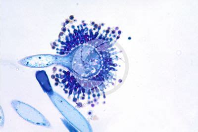 Aspergillus Sp Ascomycota Fungi Plant Histology Photos