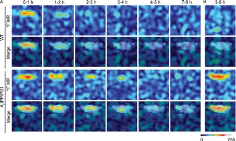 Time Course Of Changes In Fluorine Magnetic Resonance F Mr