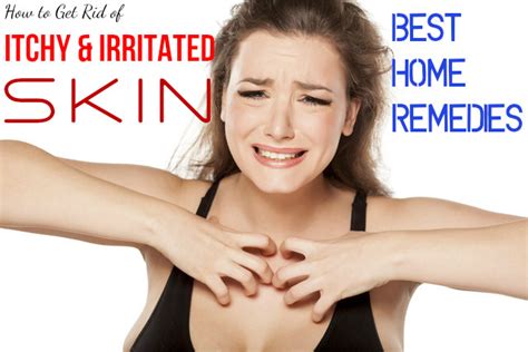 How To Get Rid Of Itchy And Irritated Skin Best Home Remedies Stylish