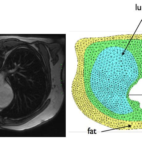 MRI 2D Slice Of The Torso Left 2D Computational Mesh Of The Torso