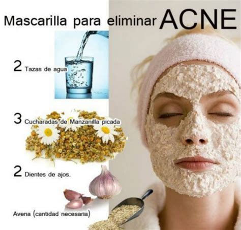 Mascarillas Caseras Para El Acn Que Debes Probar Ya Actitudfem