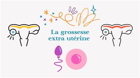 Grossesse Extra Ut Rine La Petite Tani Re