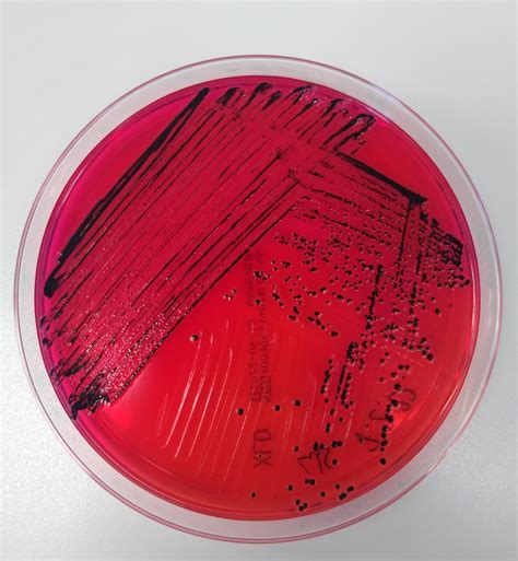 Xld Agar Shigella