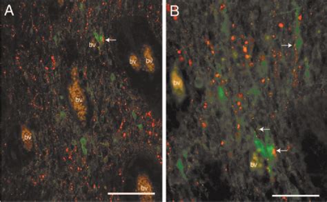 Figure From Melanopsin Is Expressed In Pacap Containing Retinal